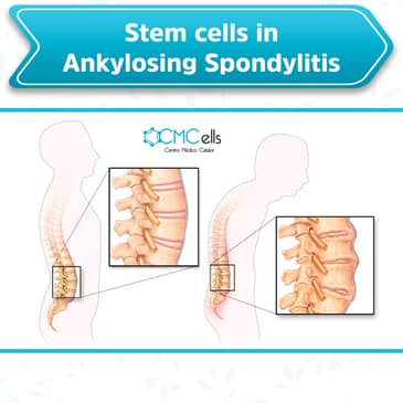 Slider image (7) Cmcells, Centro Medico Celular, (Stem Cells Medical Center)